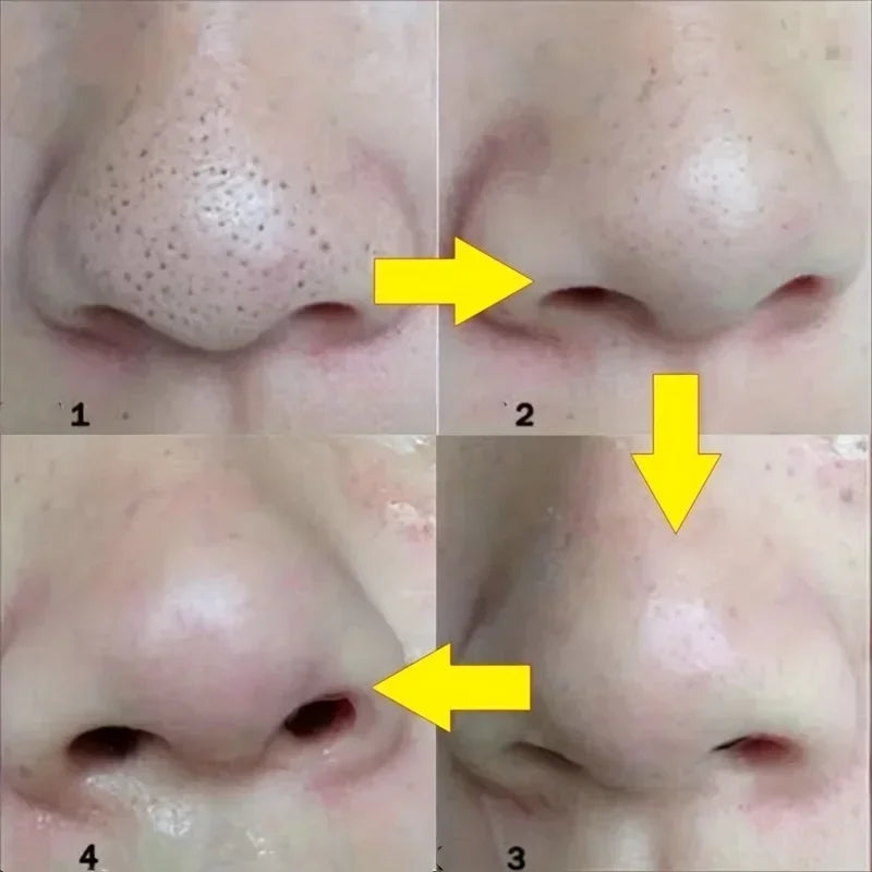 Nose Detox - NEW IDEAS
